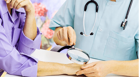 Diagnose und Behandlung von Papillomen